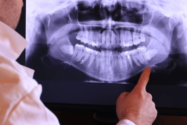 Best Emergency Dentist for Special Needs Patients in Vergennes, VT