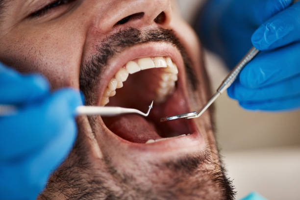 Best Emergency Dental Services for Seniors in Vergennes, VT